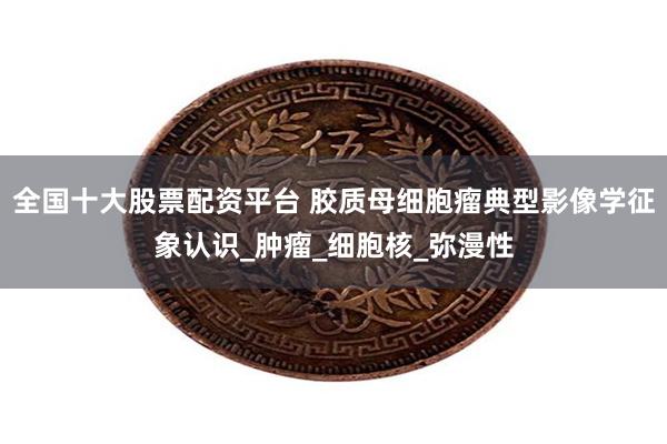 全国十大股票配资平台 胶质母细胞瘤典型影像学征象认识_肿瘤_细胞核_弥漫性